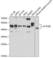 ACTL6B Rabbit pAb