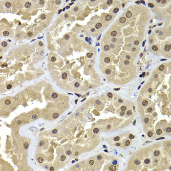 ACTL6B Rabbit pAb