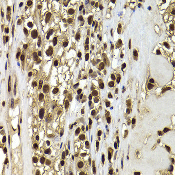 ACTL6B Rabbit pAb