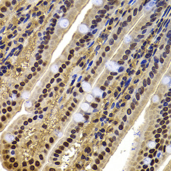 ACTL6B Rabbit pAb