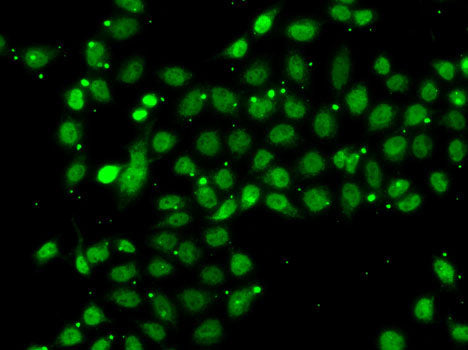 ACTL6B Rabbit pAb