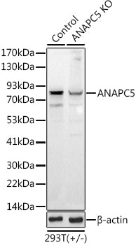 [KO Validated] ANAPC5 Rabbit pAb