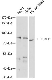 TRMT1 Rabbit pAb