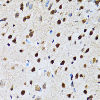 CCAR2 Rabbit pAb