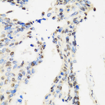 CCAR2 Rabbit pAb