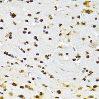CCAR2 Rabbit pAb
