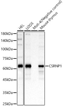 CSRNP1 Rabbit pAb