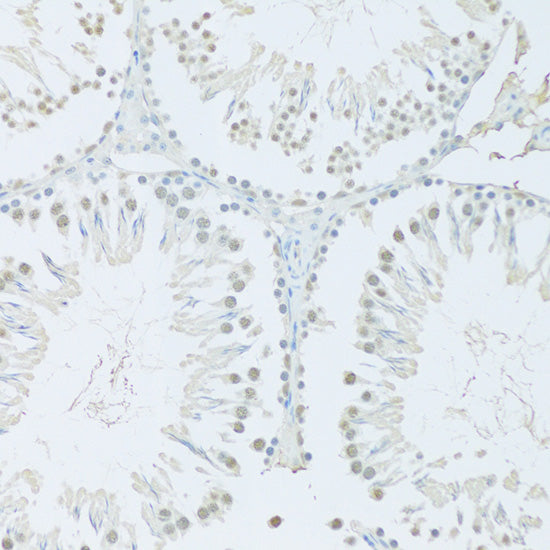 FIP1L1 Rabbit pAb