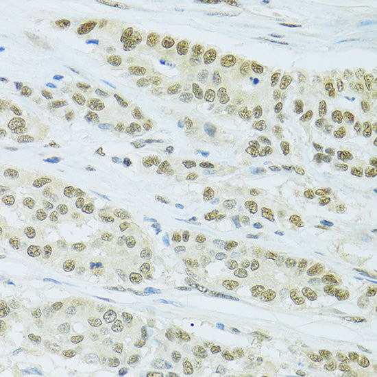 FIP1L1 Rabbit pAb