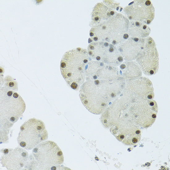 FIP1L1 Rabbit pAb