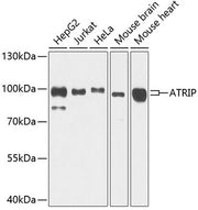 ATRIP Rabbit pAb