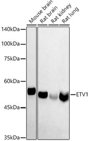 ETV1 Rabbit pAb