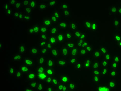 PHIP Rabbit pAb