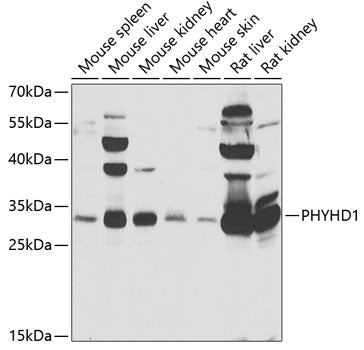 PHYHD1 Rabbit pAb