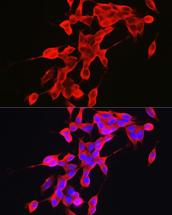 α-Synuclein Rabbit pAb
