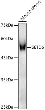SETD6 Rabbit pAb