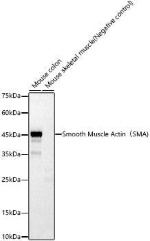 α-Smooth Muscle Actin (ACTA2) Rabbit pAb
