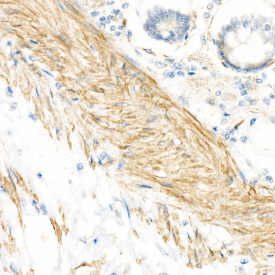 α-Smooth Muscle Actin (ACTA2) Rabbit pAb