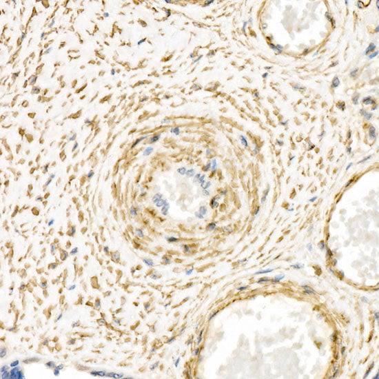 α-Smooth Muscle Actin (ACTA2) Rabbit pAb