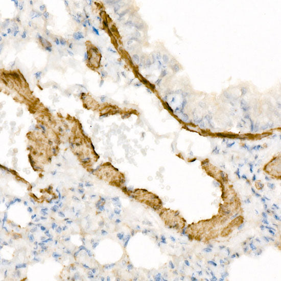 α-Smooth Muscle Actin (ACTA2) Rabbit pAb