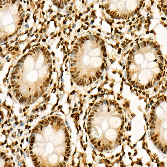 Acetyl-Histone H3-K27 Rabbit pAb