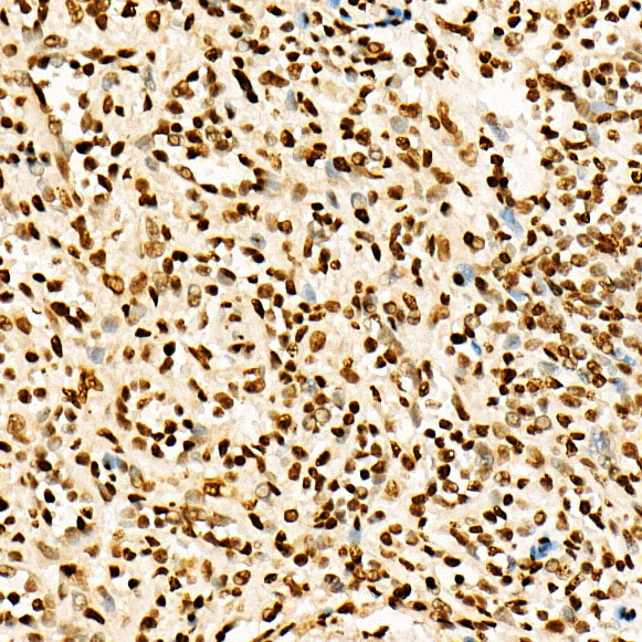Acetyl-Histone H3-K27 Rabbit pAb