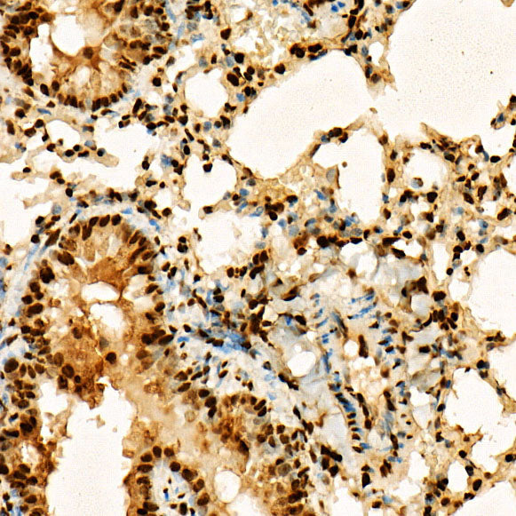 Acetyl-Histone H3-K27 Rabbit pAb