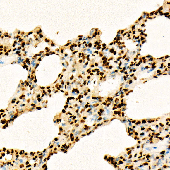 Acetyl-Histone H3-K27 Rabbit pAb