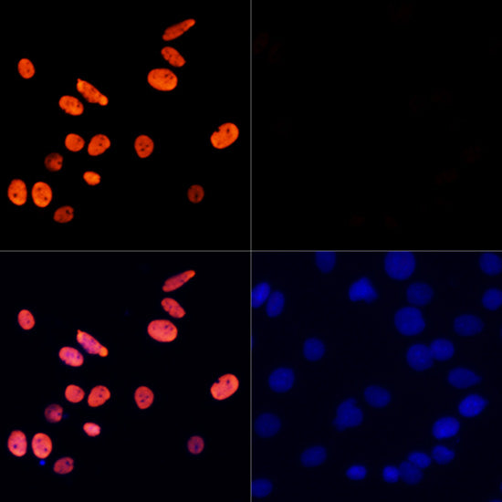 Acetyl-Histone H3-K27 Rabbit pAb