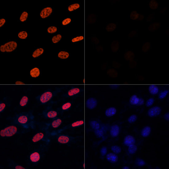 Acetyl-Histone H3-K27 Rabbit pAb