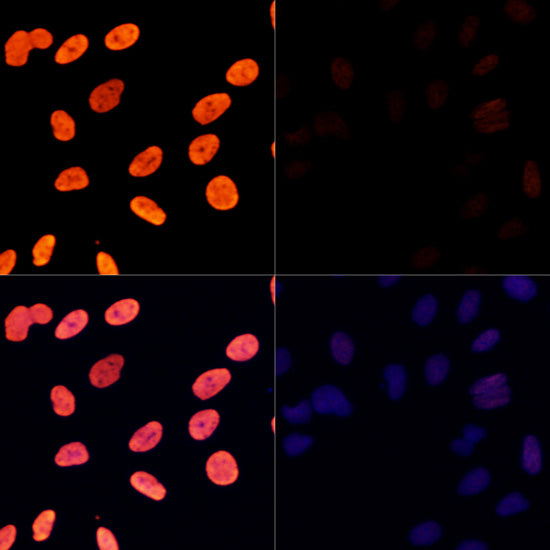 Acetyl-Histone H3-K27 Rabbit pAb