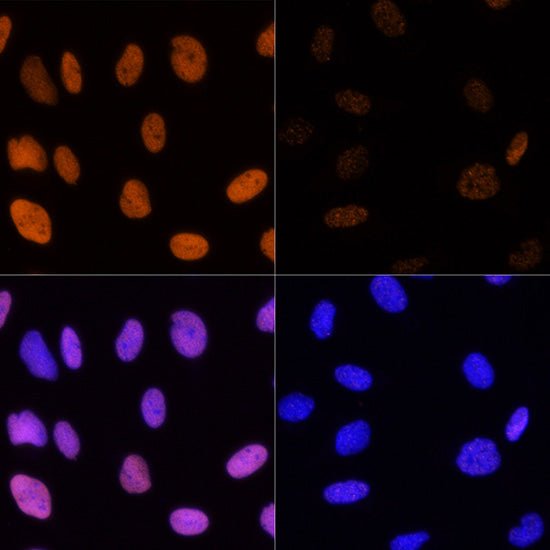 Acetyl-Histone H3-K14 Rabbit pAb