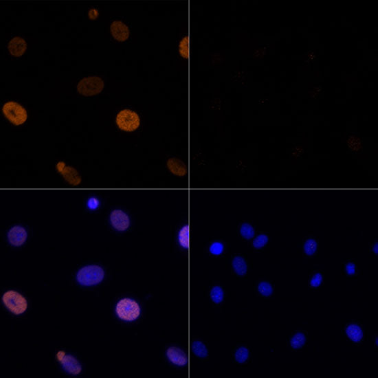 Acetyl-Histone H3-K56 Rabbit pAb