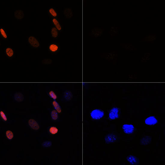 Acetyl-Histone H3-K56 Rabbit pAb