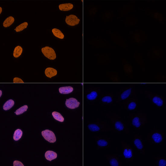 Acetyl-Histone H3-K56 Rabbit pAb