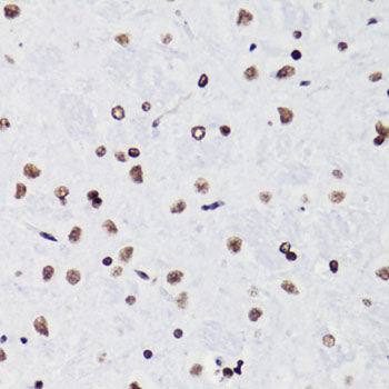 Acetyl-Histone H3-K18 Rabbit pAb