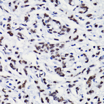 Acetyl-Histone H3-K18 Rabbit pAb