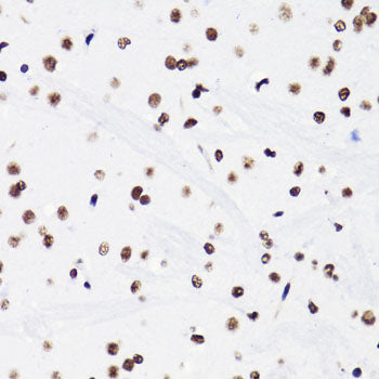 Acetyl-Histone H3-K18 Rabbit pAb