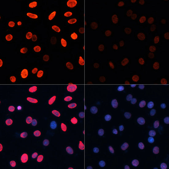 Acetyl-Histone H3-K18 Rabbit pAb