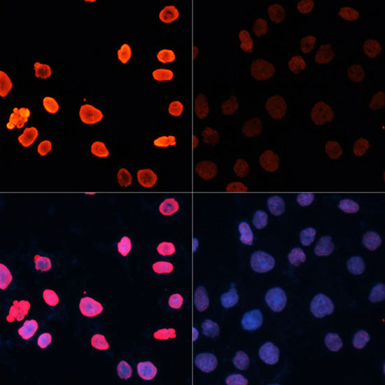 Acetyl-Histone H3-K18 Rabbit pAb