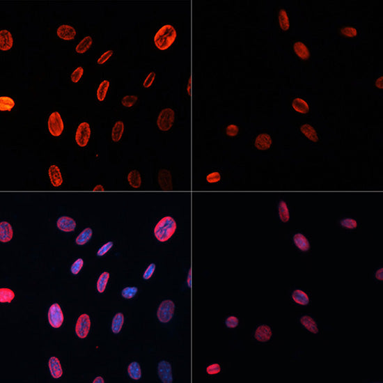 Acetyl-Histone H3-K18 Rabbit pAb