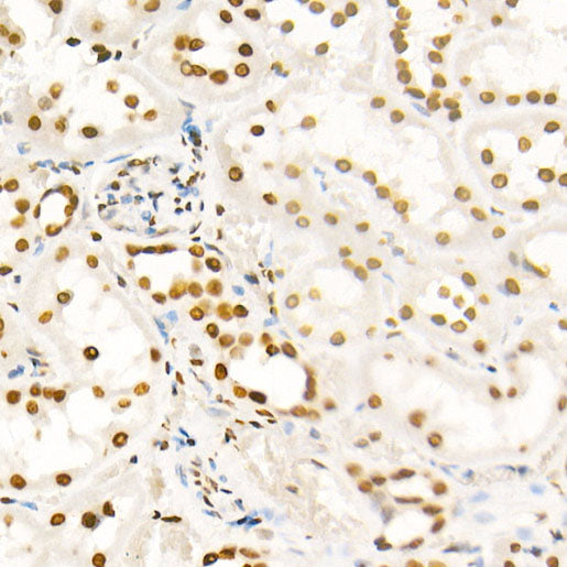 Acetyl-Histone H4-K8 Rabbit pAb