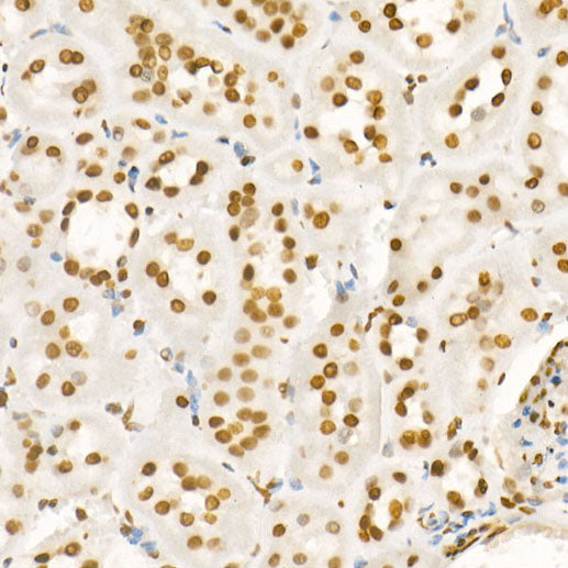 Acetyl-Histone H4-K8 Rabbit pAb
