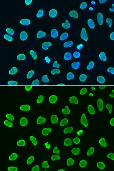 Acetyl-Histone H4-K8 Rabbit pAb