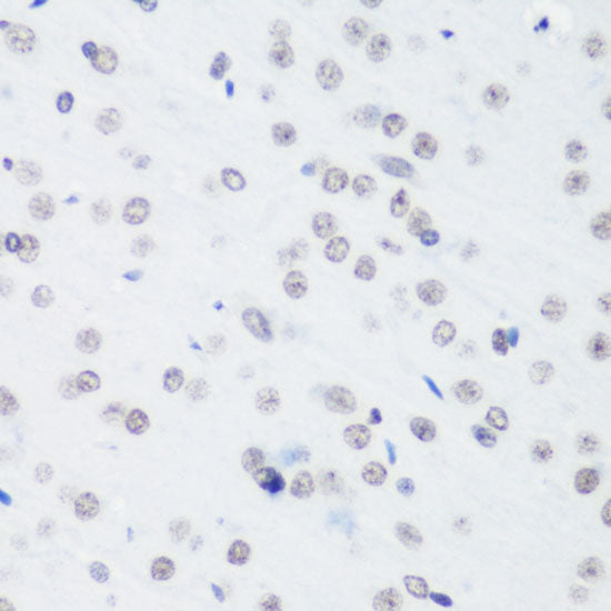 TriMethyl-Histone H3-K64 Rabbit pAb