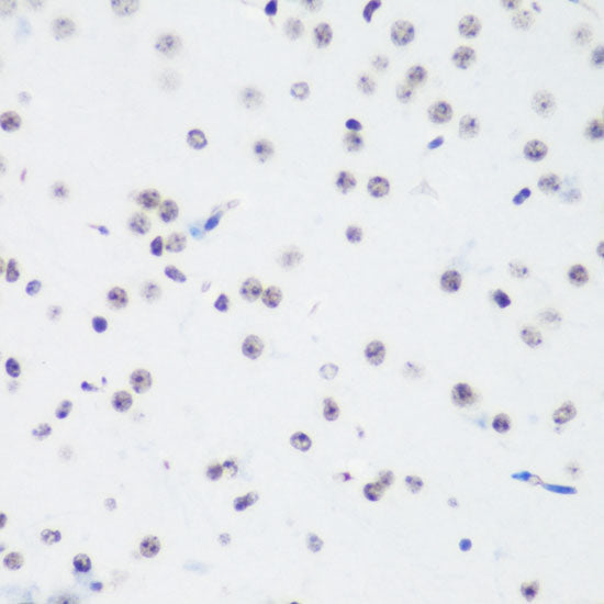 TriMethyl-Histone H3-K64 Rabbit pAb