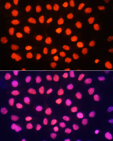 TriMethyl-Histone H3-K64 Rabbit pAb