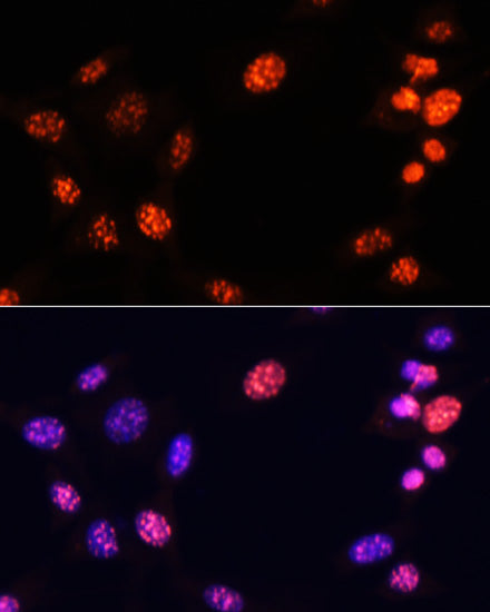 TriMethyl-Histone H3-K64 Rabbit pAb