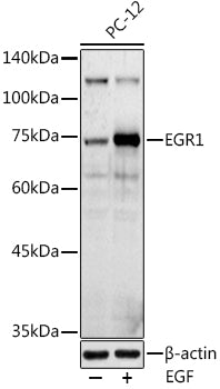 EGR1 Rabbit pAb