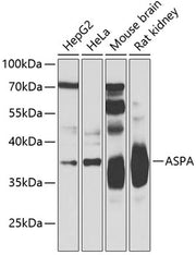 ASPA Rabbit pAb